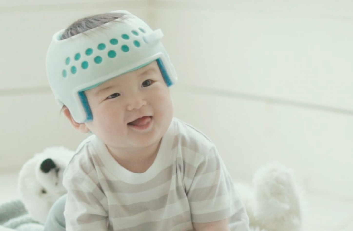 赤ちゃんの頭のゆがみを治療するヘルメット アイメット